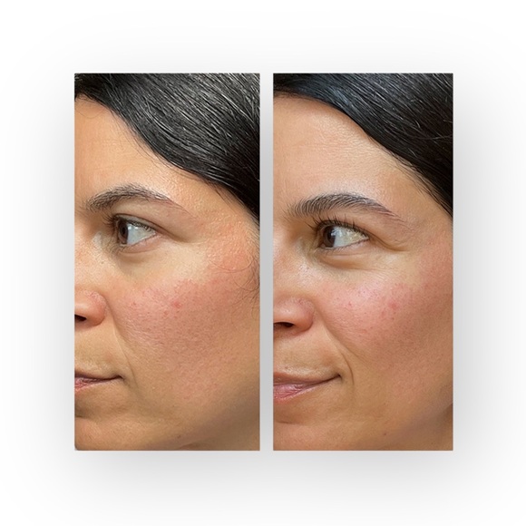 new Tata Harper ☀︎︎ Regenerating Cleanser Daily BHA Exfoliator ☀︎︎ 50ml Sealed - Picture 12 of 16